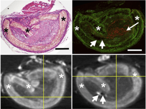 H&E stained section (top left) matched to the corresponding axial μCT image (bottom left) and a section stained with anti-NF (to right) matched to the axial μCT image (bottom). Asterisks label nerve conduits. The long arrow in points to a group of anti-NF stained axons and short arrows point to a small pocket of fat (left) and a large blood vessel (right). Scale bars = 0.5 mm 