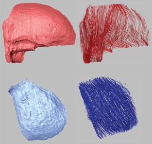 MuscleFasciclesDiceCT